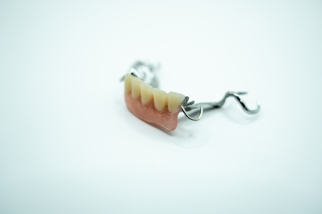 知ってる？それぞれの補綴物の寿命