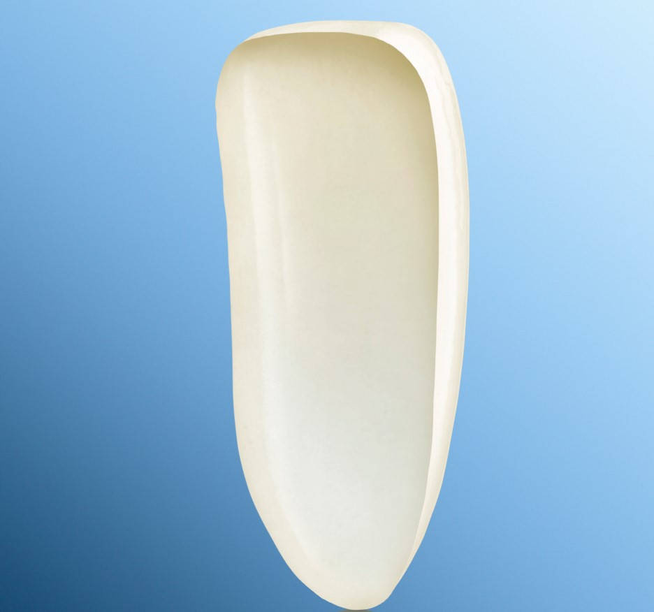 歯の変色や前歯の隙間にも対応できるラミネートべニアってなに？